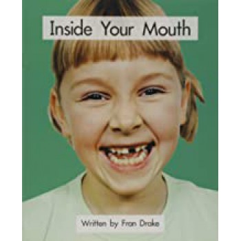 Inside Your Mouth! - 21