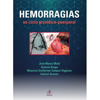 Hemorragias Do Ciclo Gravídico Puerperal