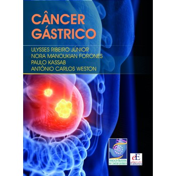 C?ncer Gástrico