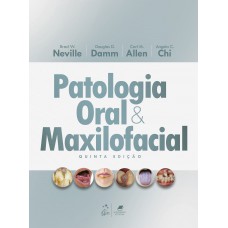 Patologia Oral E Maxiloacial