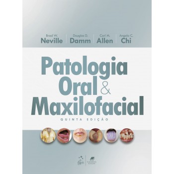 Patologia Oral E Maxiloacial