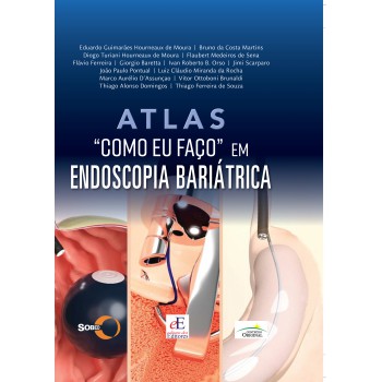 Atlas: Como Eu Faço Em Endoscopia Bariátrica