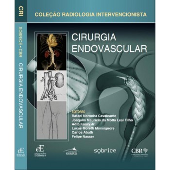 Cirurgia Endovascular: Coleção Radiologia Intervencionista