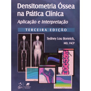 Densitometria óssea Na Prática Clínica - Aplicação E Interpretação