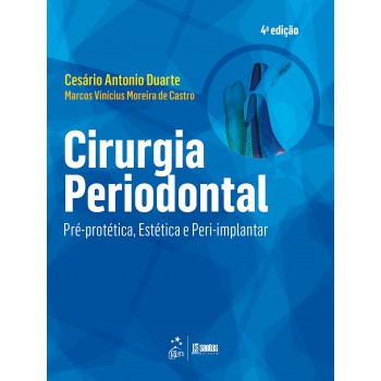 Cirurgia Periodontal - Pré-protética, Estética E Peri-implantar