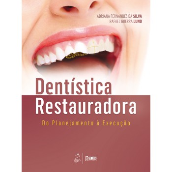 Dentística Restauradora - Do Planejamento à Execução