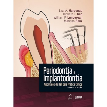 Periodontia E Implantodontia - Algoritmos De Hall Para Prática Clínica