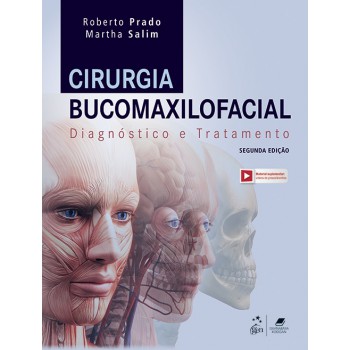 Cirurgia Bucomaxilofacial - Diagnóstico E Tratamento