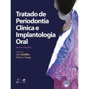 Tratado De Periodontia Clínica E Implantologia Oral