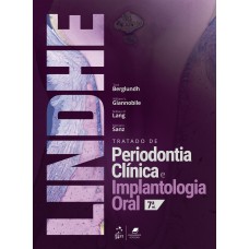 Tratado De Periodontia Clinica E Implantologia Oral