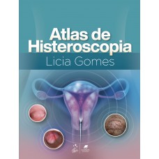 Atlas De Histeroscopia