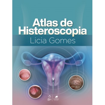 Atlas De Histeroscopia