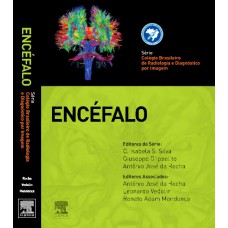 Cbr - Encéfalo