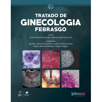 Febrasgo - Tratado De Ginecologia