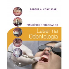 Princípios E Práticas Do Laser Na Odontologia