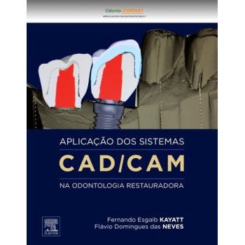 Aplicação Dos Sistemas Cad/cam Na Odontologia