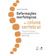 Deformações Morfológicas Da Coluna Vertebral: Tratamento Fisioterápico Em Reeducação Postural Global - Rpg