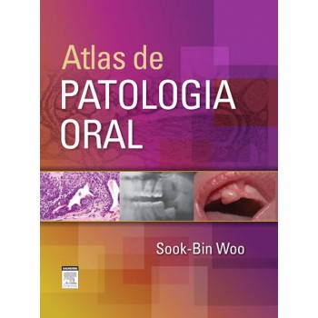 Atlas De Patologia Oral