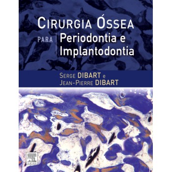 Cirurgia óssea Para Periodontia E Implantodontia