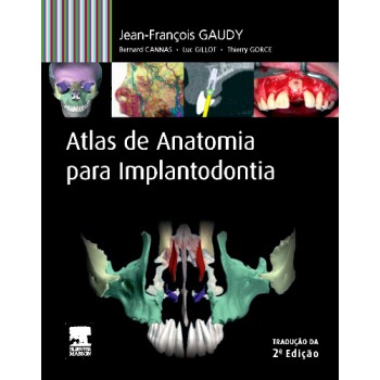 Atlas De Anatomia Para Implantodontia