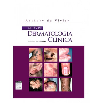 Atlas De Dermatologia Clínica