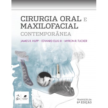 Cirurgia Oral E Maxilofacial Contemporânea