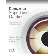 Doenças Da Superfície Ocular: Córnea, Conjuntiva E Filme Lacrimal