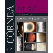 Atlas De Córnea