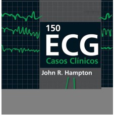 150 ECG - Casos Clínicos