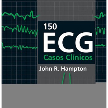 150 Ecg - Casos Clínicos