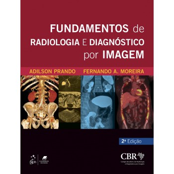 Cbr - Fundamentos De Radiologia E Diagnóstico Por Imagem