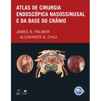 Atlas De Cirurgia Endoscópica Nanossinusal E Da Base Do Crânio