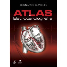 Atlas De Eletrocardiografia