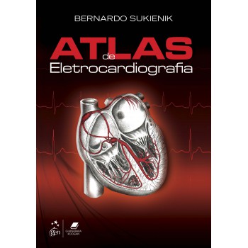 Atlas De Eletrocardiografia