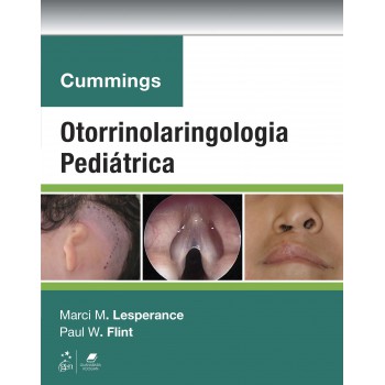 Cummings Otorrinolaringologia Pediátrica