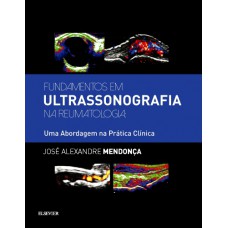 Fundamentos Em Ultrassonografia Na Reumatologia: Uma Abordagem Na Prática Clínica