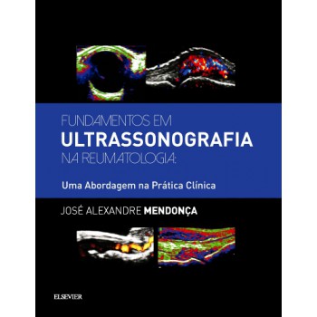 Fundamentos Em Ultrassonografia Na Reumatologia: Uma Abordagem Na Prática Clínica