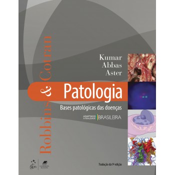 Robbins & Cotran Patologia - Bases Patológicas Das Doenças