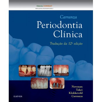 Carranza Periodontia Clínica