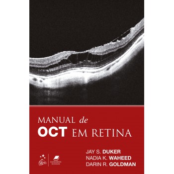 Manual De Oct Em Retina