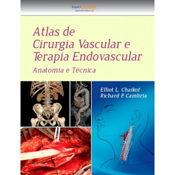 Atlas De Cirurgia Vascular E Terapia Endovascular: Anatomia E Técnica