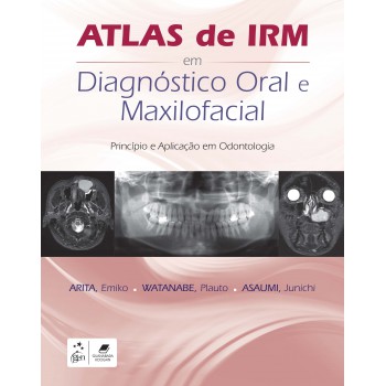 Atlas De Irm Em Diagnóstico Oral E Maxilofacial: Princípio E Aplicação Em Odontologia