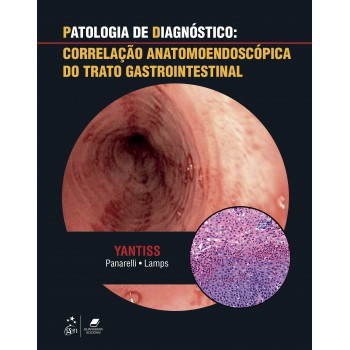 Patologia De Diagnóstico: Correlação Anatomoendoscópica Do Trato Gastrointestinal