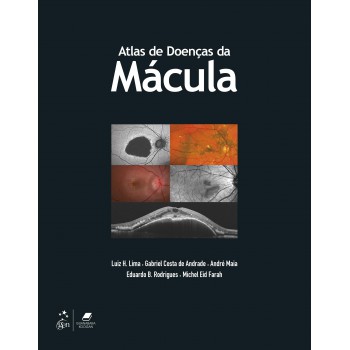 Atlas De Doenças Da Mácula