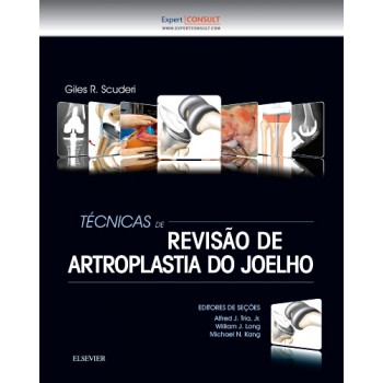 Técnicas De Revisão De Artroplastia Do Joelho