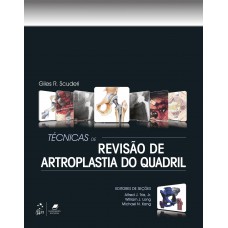 Técnicas De Revisão De Artroplastia Do Quadril