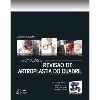 Técnicas De Revisão De Artroplastia Do Quadril