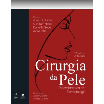 Cirurgia Da Pele - Procedimentos Em Dermatologia