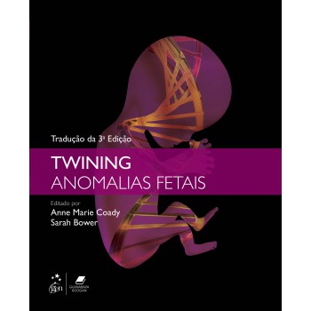 Twining Anomalias Fetais