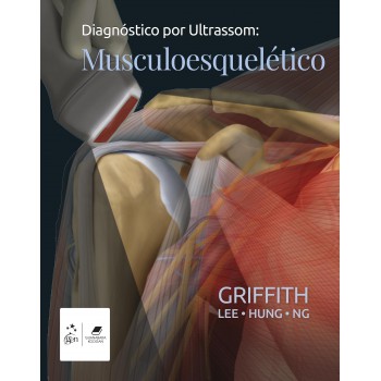 Diagnóstico Por Ultrassom: Musculoesquelético